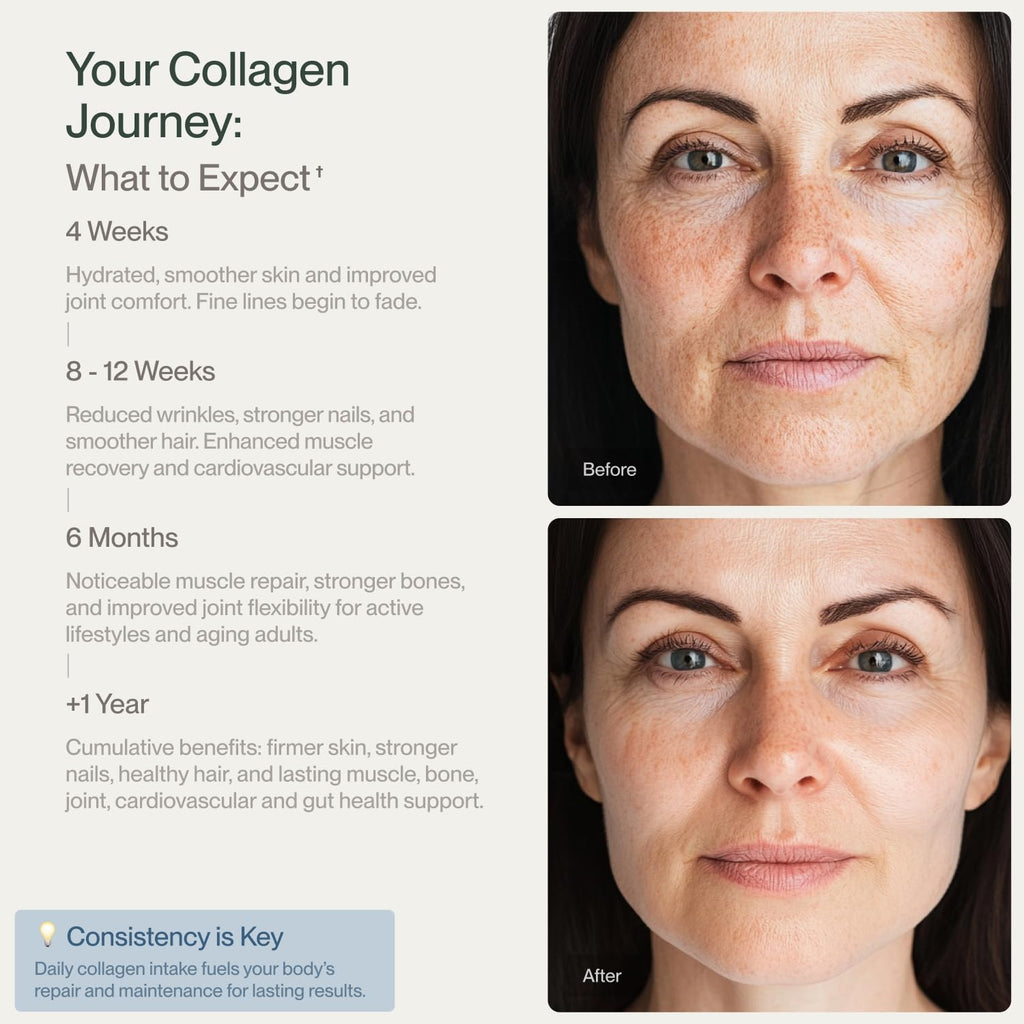 Collagen Peptides Powder Grass-Fed Pasture-Raised Hydrolyzed Type I & III Unflavored 32 oz R639262